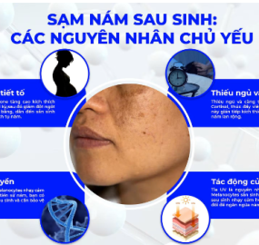 SẠM NÁM SAU SINH: GIẢI PHÁP AN TOÀN VÀ HIỆU QUẢ RÕ RỆT